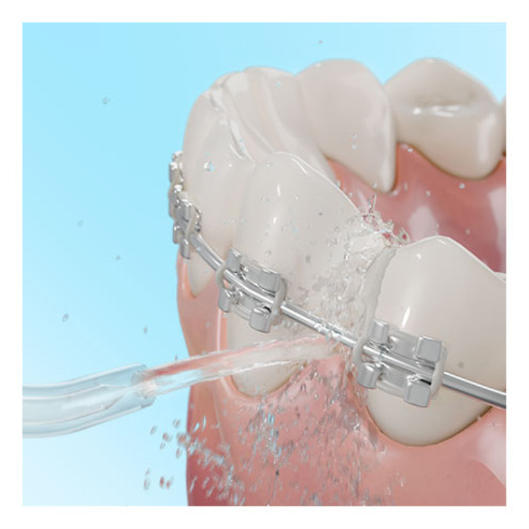 IRRIGADOR BUCAL CECOTEC BAMBA TOOTHCARE 1200 JET PRO V - detalle